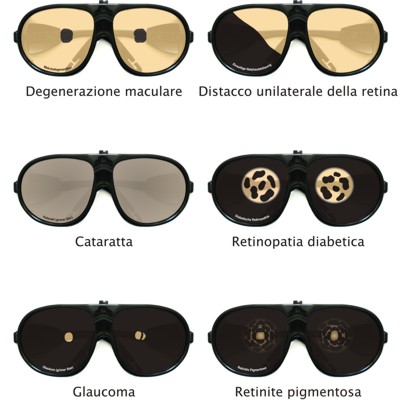 Set di occhiali per la simulazione di malattie dellocchio